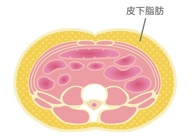 皮下脂肪断面
