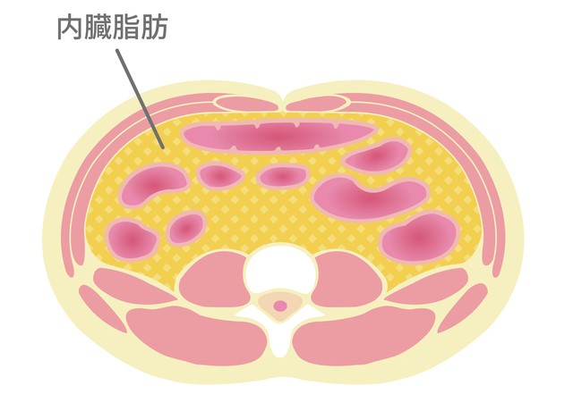 内臓脂肪断面